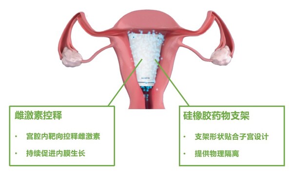 喜报 | 易浦润（上海）生物技术有限公司佩朵®硅橡胶子宫药物支架系统获批